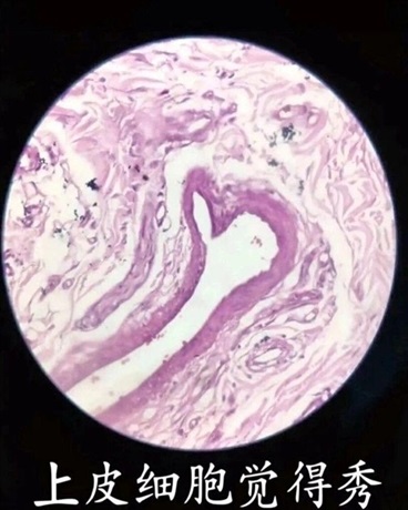 上皮细胞觉得很秀
